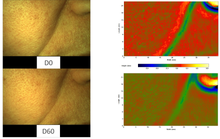 Load image into Gallery viewer, Non-injectable FILLER cream